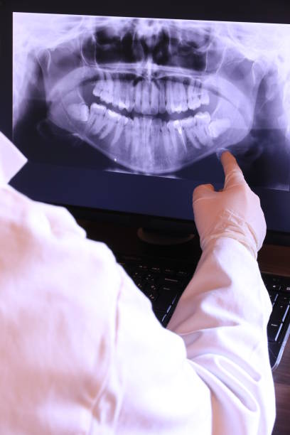 Best Emergency Tooth Extraction in Van Buren, MO